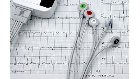 “Viaggio nel Cuore”, ad Alghero congresso sulle novità controverse in Cardiologia