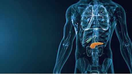 Tumore al pancreas, visto per la prima volta cosa accelera la malattia
