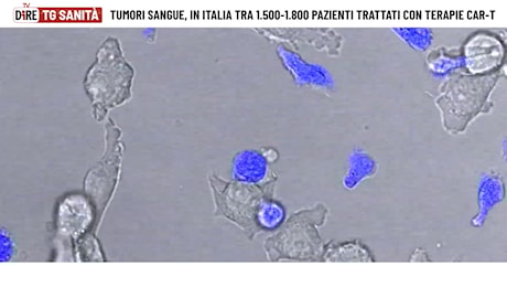 Tg Sanità, l’edizione di lunedì 14 aprile 2025
