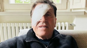 Gianni Morandi con una benda sull'occhio: Ho fatto a pugni. Antonella Clerici: Che è successo ancora?. I commenti