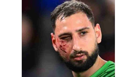 Donnarumma, trauma facciale con ferite multiple